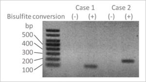 bisulfite conversion kit (magnetic beads)