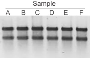 Bacteria RNA extraction BioDynami