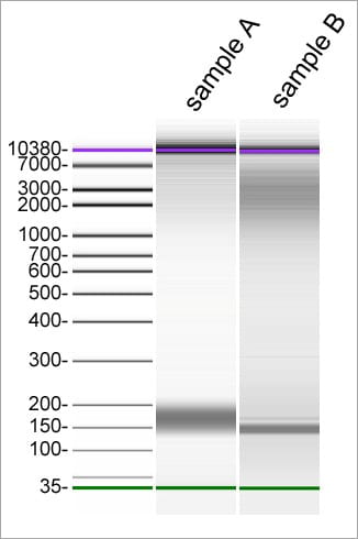 Cell-free DNA-RNA Extraction Plasma Serum data